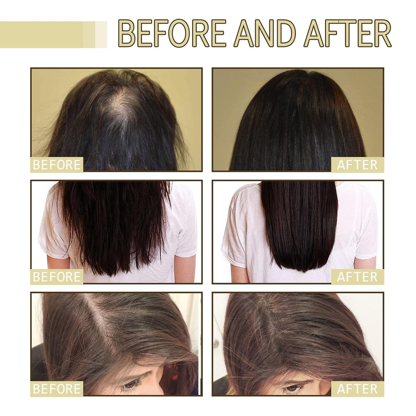 EELHOE Rosemary Hair Growth Oil Serum - 3-Pack Natural Formula for Hair Thinning (60ml Each)