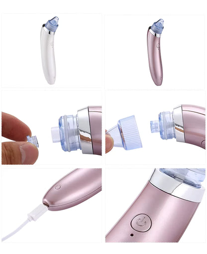 Ultimate 4-in-1 Rechargeable Blackhead Remover & Facial Pore Vacuum with Steamer – Deep Cleansing & Skin Tightening Technology