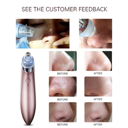 Ultimate 4-in-1 Rechargeable Blackhead Remover & Facial Pore Vacuum with Steamer – Deep Cleansing & Skin Tightening Technology