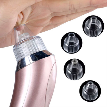 Ultimate 4-in-1 Rechargeable Blackhead Remover & Facial Pore Vacuum with Steamer – Deep Cleansing & Skin Tightening Technology
