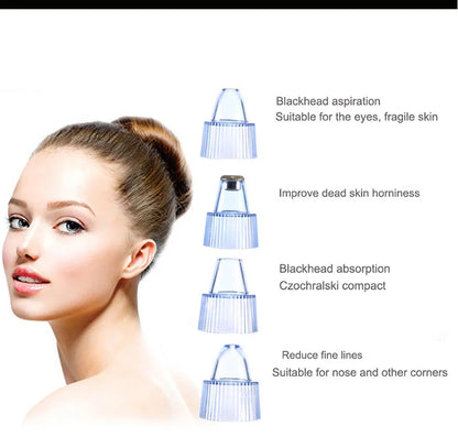 Ultimate 4-in-1 Rechargeable Blackhead Remover & Facial Pore Vacuum with Steamer – Deep Cleansing & Skin Tightening Technology